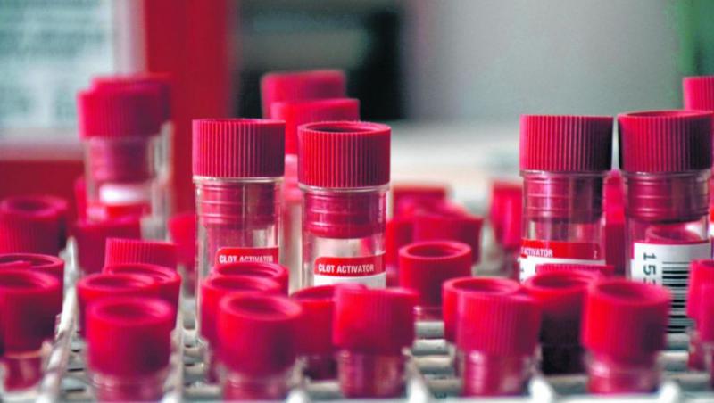 Desde octubre, R&iacute;o Negro implementar&aacute; un test r&aacute;pido para detectar s&iacute;filis